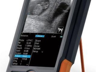 Ultrasonido veterinario portatil siui cts 800 v en Culiacán | Clasf imagen-y-sonido